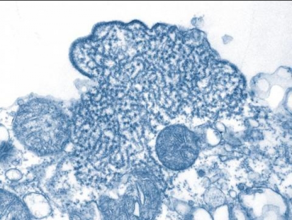 Роспотребнадзор разработал современную тест-систему для диагностики вируса Нипах в России