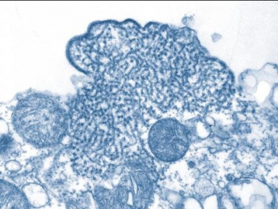 Роспотребнадзор разработал современную тест-систему для диагностики вируса Нипах в России