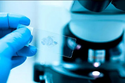 Врач Майра Калеффи предупредила о росте заболеваемости раком в Латинской Америке на 83%